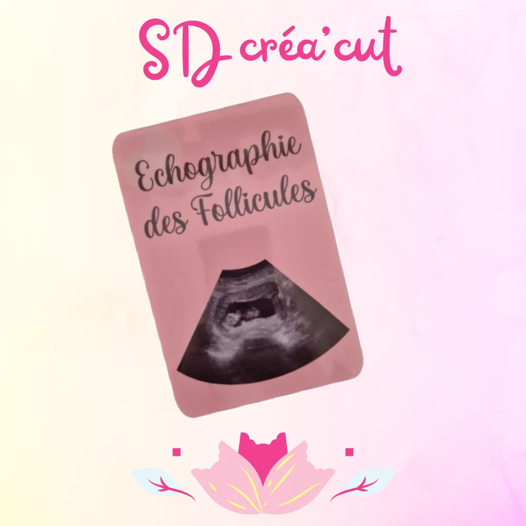 Cartes Étapes PMA  Solo ou en Couple Homo